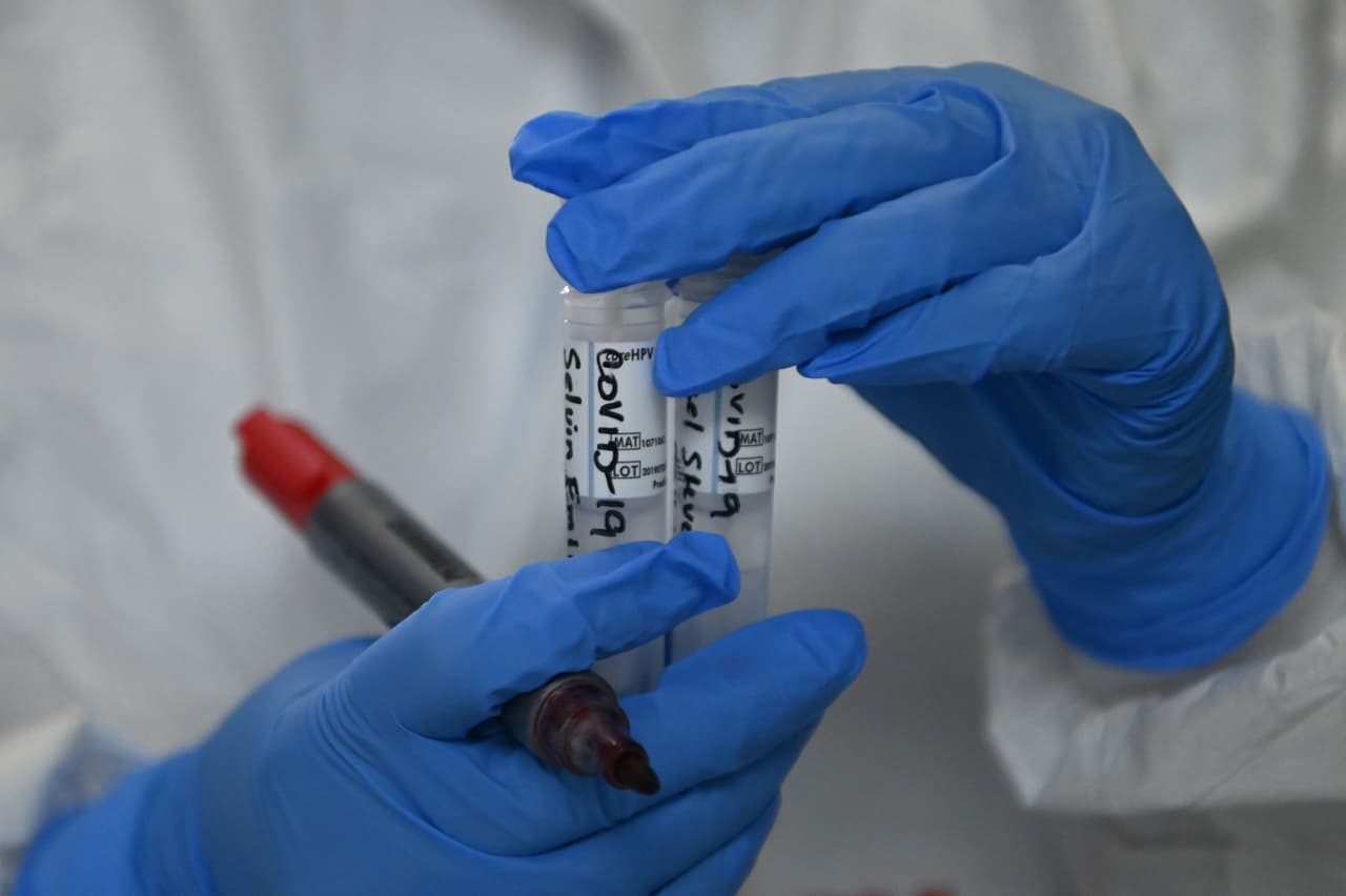 El Departamento recomienda seguir las mismas acciones de protección contra el coronavirus, incluyendo recibir la vacuna contra el coronavirus, usar una mascarilla en espacios públicos y evitar aglomeraciones.