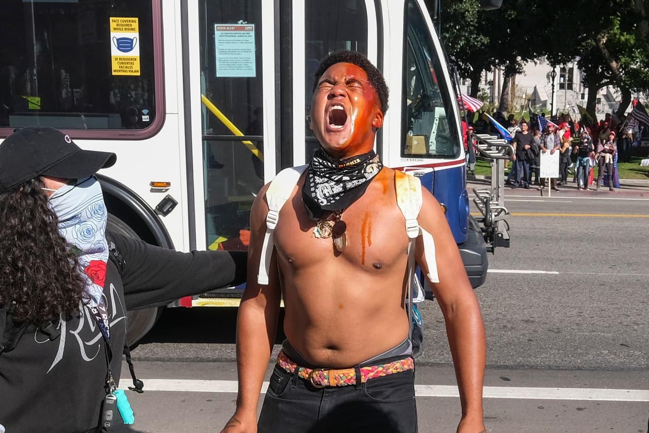 El oficial de LAPD, Tony Im, dijo que 
<b>hubo "varias peleas" durante la manifestación.</b>