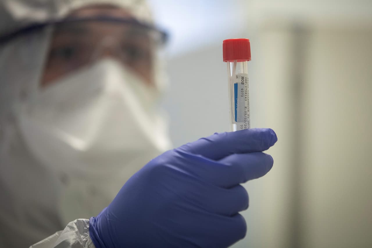 Expertos señalan que las pruebas son sencillas y se pueden llevar a cabo con muestras de las secreciones nasales, la sangre u otros líquidos del cuerpo.