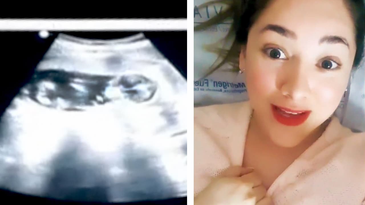 Sherlyn no pudo saber el sexo de su bebé, pero entendió por qué va a ser como ella
