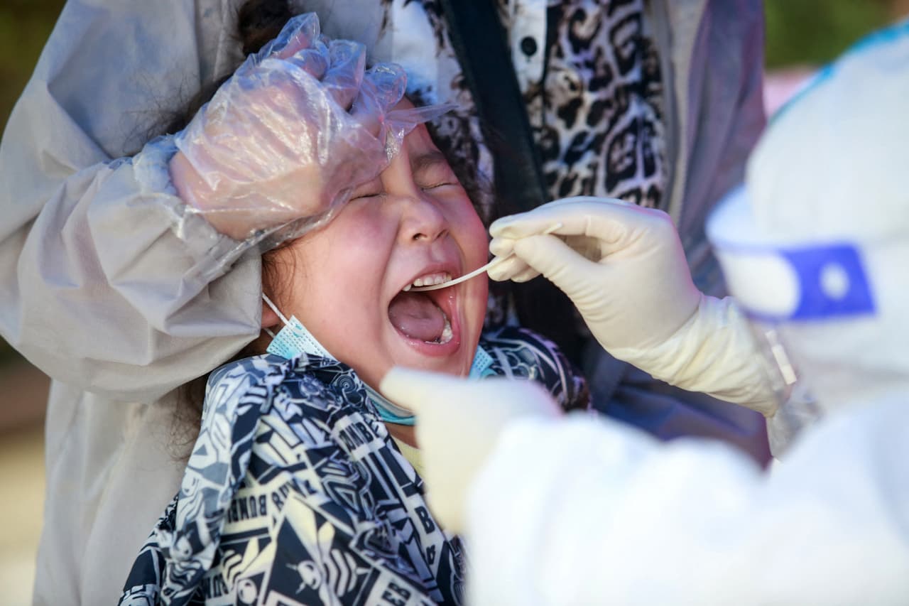 El 85% de los niños con complicaciones por coronavirus tienen condiciones preexistentes como obesidad, dice pediatra en California 