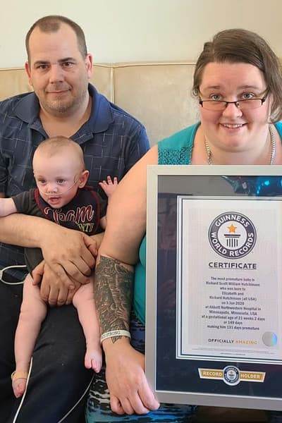 Ese día, la organización 
<a href="https://www.guinnessworldrecords.com/news/2021/6/worlds-most-premature-baby-given-0-odds-of-survival-celebrates-first-birthday-663394" target="_blank">Guinness World Records</a> le entregó el reconocimiento como el bebé más prematuro que ha sobrevivido.