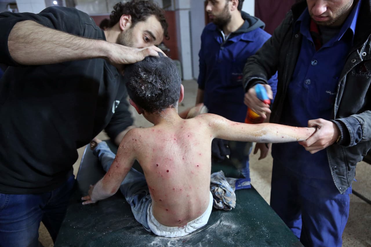 5 de marzo. La espalda de un niño herido después de los bombardeos en Hamouria, ciudad controlada por rebeldes en las afueras de la capital, Damasco. El desastre es tal el Guta Oriental, que hay quienes la llaman la nueva Aleppo, enclave que fue la anterior 'capital' del desastre humanitario sirio.