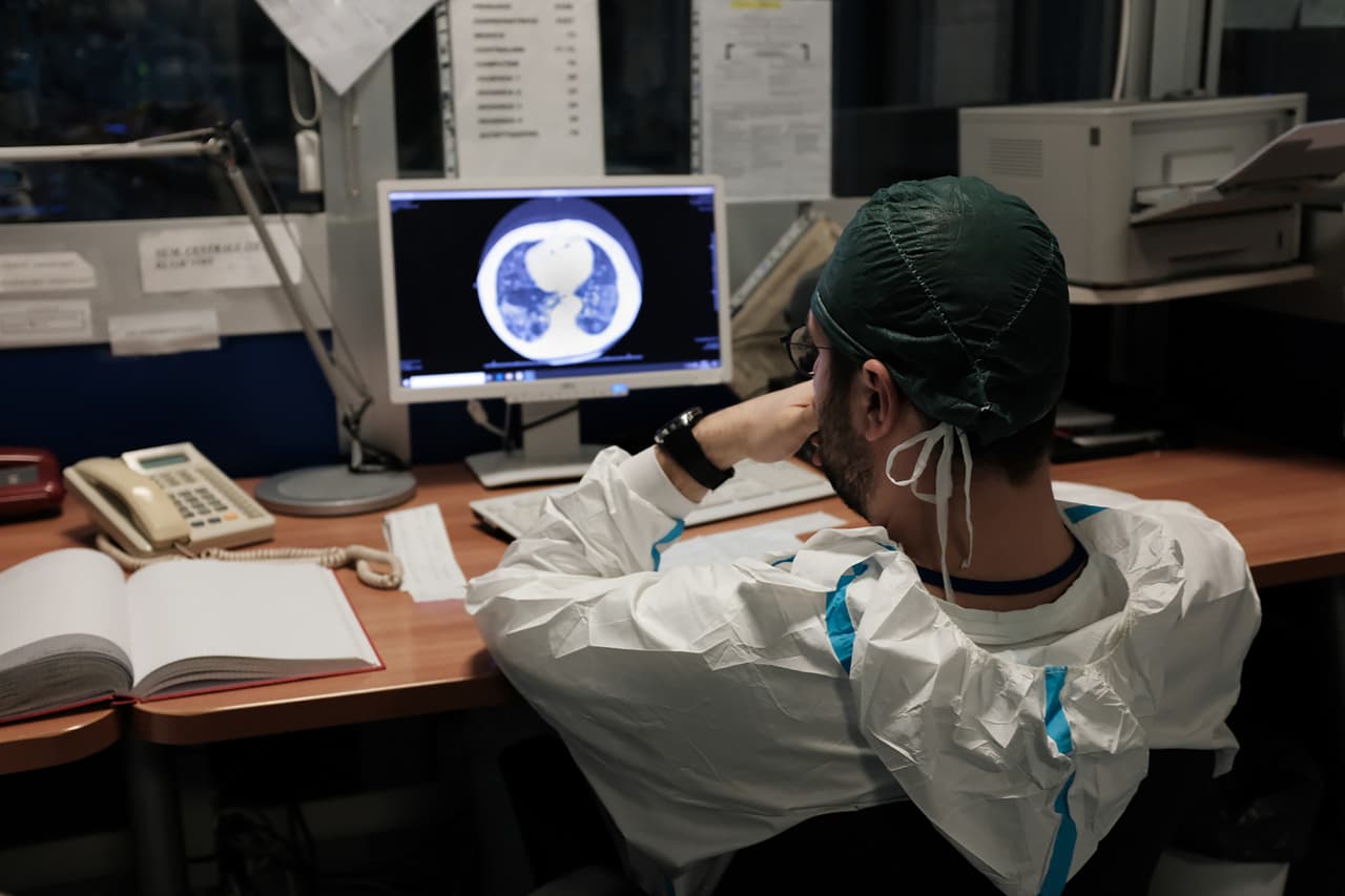 Un médico examina una tomografía computarizada pulmonar de un paciente con covid-19 el 13 de marzo. La cantidad de fallecidos en Italia por el coronavirus es más del doble que la de China, donde se originó la pandemia.