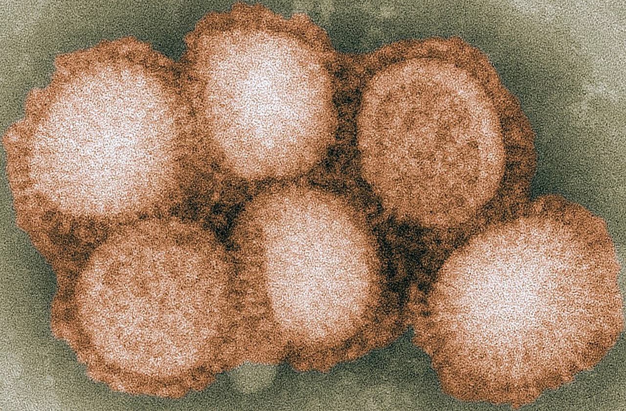 <b>Gripe asiática (1957-1958). </b>Este brote dejó cerca de dos millones de fallecidos en China, Singapur, Hong Kong y Estados Unidos. Fue generado por una cepa de versiones mixtas del virus H2N2 (en la foto), y gracias al rápido desarrollo de una vacuna y a la disponibilidad de antibióticos la propagación de la enfermedad fue limitada.
