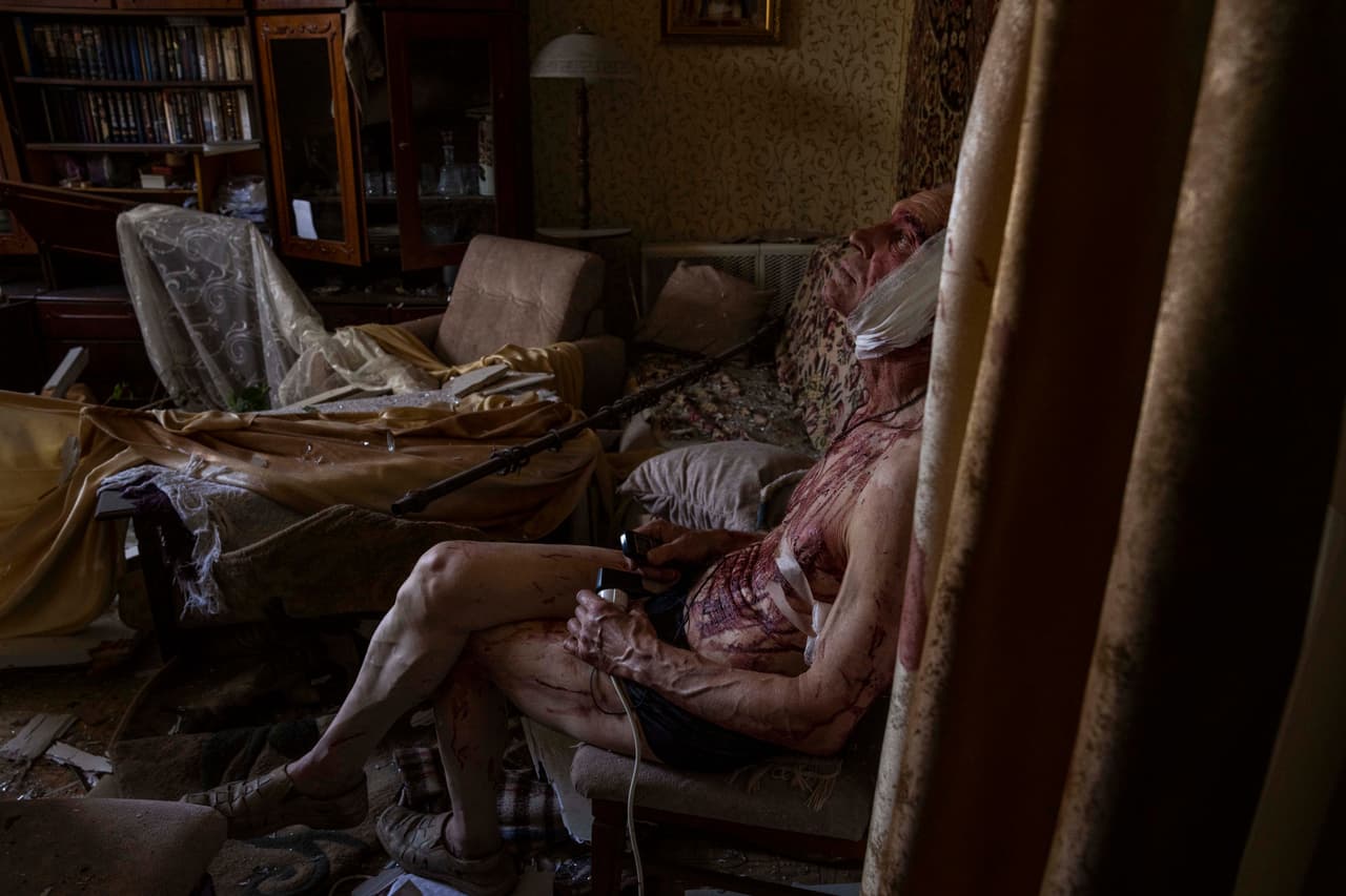 Volodymyr, de 66 años, herido por un bombardeo ruso, se sienta en una silla en su apartamento dañado, en Kramatorsk, Donetsk, este de Ucrania, el 7 de julio.