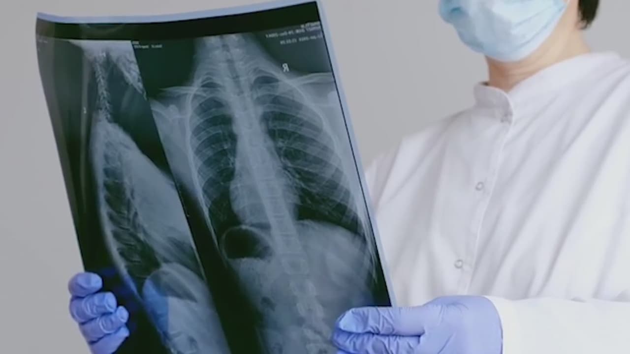<b>¿Qué tan fuerte será la protección de refuerzo y cuánto durará? </b>Esta es la pregunta candente que los científicos aún no pueden responder. La variante delta puede reinfectar a las personas que se han recuperado del COVID-19. Delta también puede infectar a las personas vacunadas, aunque estas infecciones de "avance" son generalmente leves y no suelen dar lugar a hospitalizaciones.