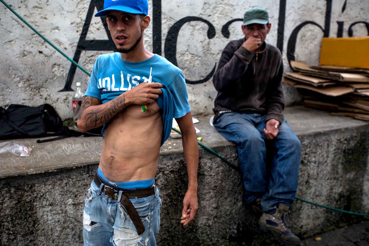 Carlos Arévalo duerme desde hace tres años en la calle y cuando tiene dinero paga "una pensión de mala muerte" en el centro de Caracas. "Y mira lo que se me pegó a mí por estar durmiendo en pensiones. 
<b>Esto es escabiosis, sarna, y no hay medicinas"</b>, dice Arévalo, levantándose la camisa. Vivía con su madre en el barrio caraqueño de Pinto Salinas. Ella murió de cáncer. Él cayó en las drogas y acabó en la calle. Su único hermano se fue del país hace dos años y vive en Estados Unidos. "No tuvo mucho problema para irse porque tiene la nacionalidad española. Yo también la tengo, pero también tengo la mala vida. Por situaciones, por problemas personales".