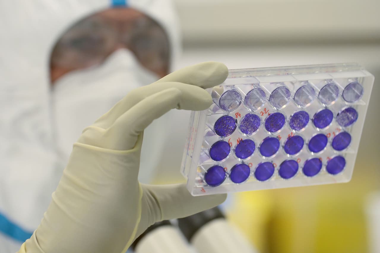 El Departamento de Servicios de Salud del Estado de Texas informó que 
<b><a href="https://www.univision.com/local/austin-kakw/texas-proporcionara-vacunas-contra-el-coronavirus-a-los-centros-de-atencion">al menos 1.4 millones de texanos recibirán la primera de dos dosis de la vacuna este mes</a></b>.
