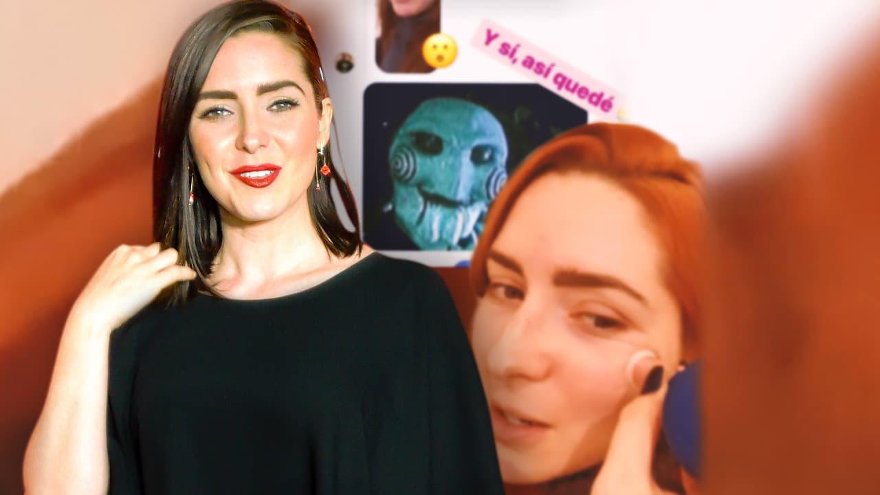 Ariadne Díaz muestra los moretones en el rostro que le dejó un fallido tratamiento de belleza