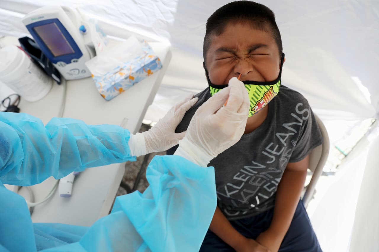 Los CDC señalaron que entre principios de marzo y hasta finales de julio, recibieron reportes de 570 jóvenes, desde bebés hasta personas de 20 años, con síntomas que encajan con el Síndrome Inflamatorio Multisistémico en niños, o MIS-C en inglés.