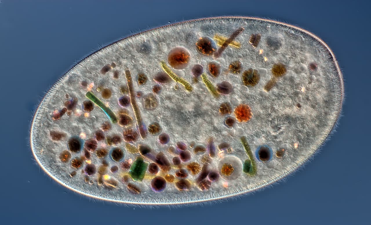 10mo puesto: 
<i>Frontonia</i> (se ven sus alimentos ingeridos, cilios, boca y tricocistos) 
<br>Rogelio Moreno Goll (Panama) — Aumento: 200x
