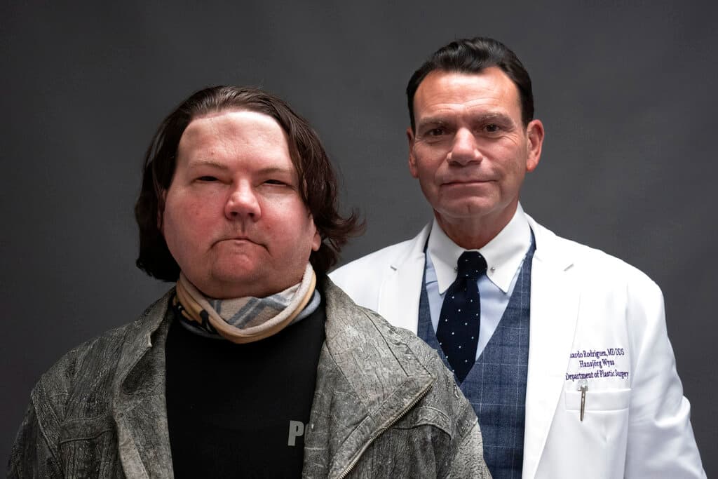 "Los pacientes tienen que comprender todo el riesgo al que se están enfrentando", dijo el doctor Eduardo Rodríguez (a la derecha en la imagen). Sin embargo, Rodríguez aseguró que el paciente resultó ser "perfecto" para el procedimiento al ser joven, fuerte y sano. "El espíritu de lucha que tiene lo ha ayudado mucho en todo este procedimiento".
