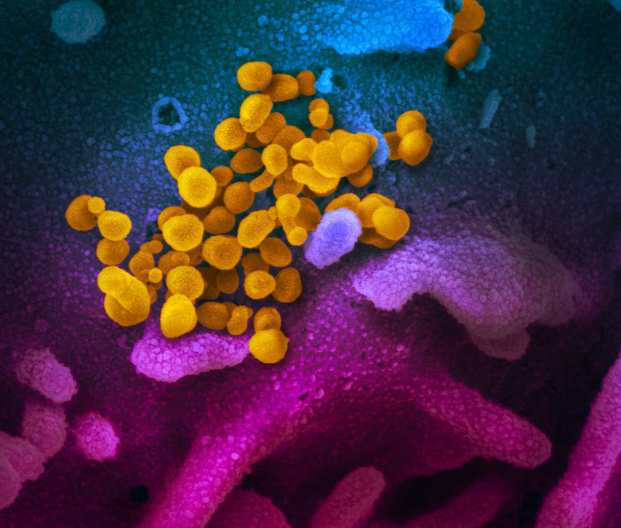 “El nuevo coronavirus es similar al MERS-CoV (el coronavirus del síndrome respiratorio del Medio Oriente, que surgió en 2012) y al SARS-CoV original (coronavirus del síndrome respiratorio agudo severo, que surgió en 2002)”, aclara NIAID en el comunicado.