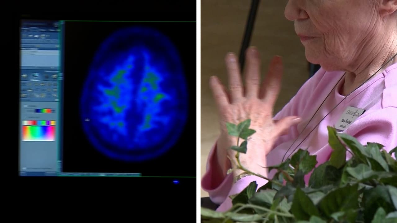 La detección temprana también puede aumentar las posibilidades de participación en 
<a href="https://www.alz.org/alzheimers-dementia/research_progress/clinical-trials" target="_blank">ensayos clínicos de medicamentos </a>que ayudan a avanzar en la investigación.