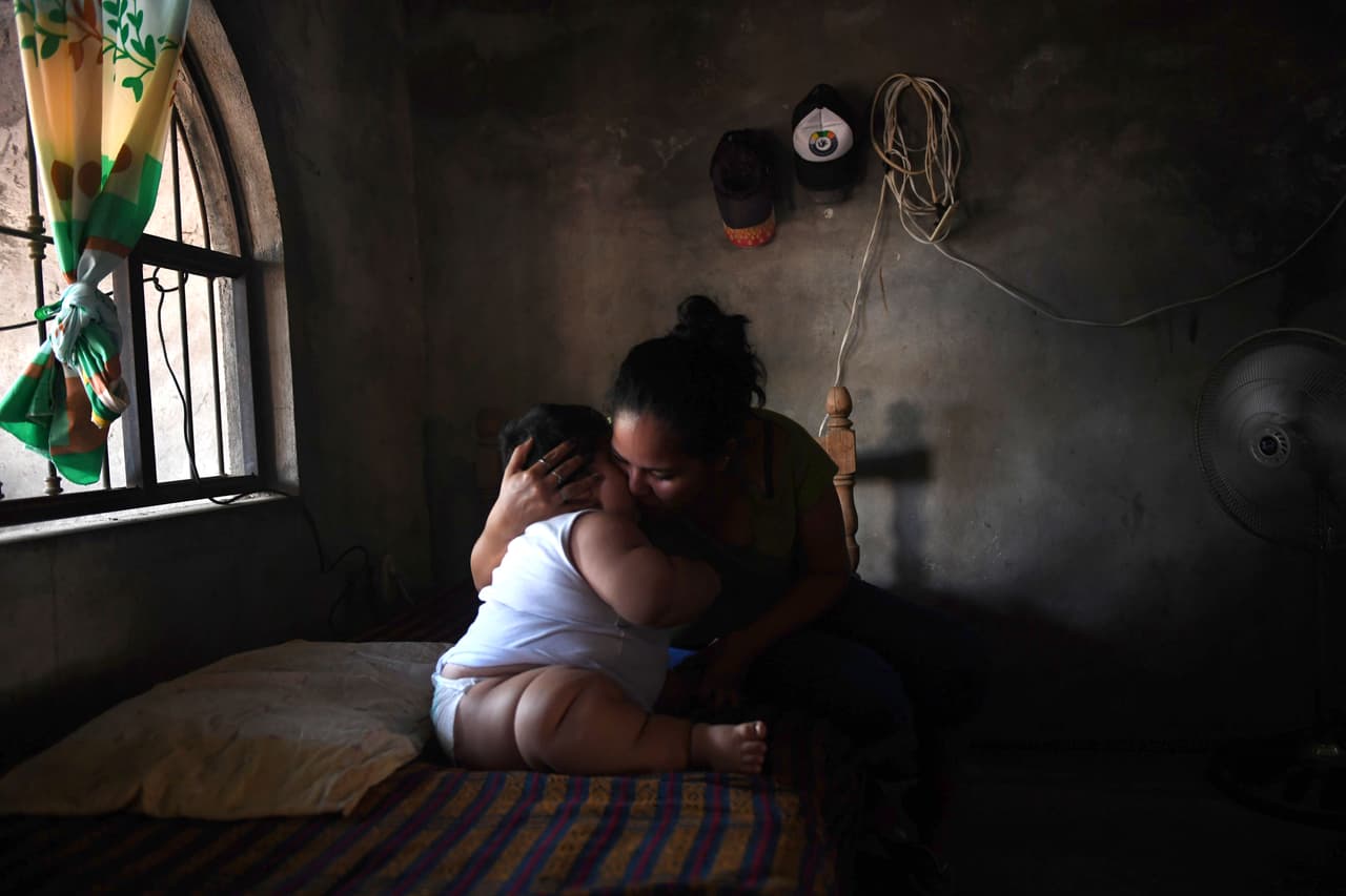 La madre de 24 años, Isabel Pantoja, dice a la agencia AFP que creía que el excesivo aumento se debía tal vez a la calidad de la leche materna que ella le daba a su hijo. Sus padres han abierto una página en Facebook y una cuenta bancaria para recibir donaciones para financiar su atención médica.