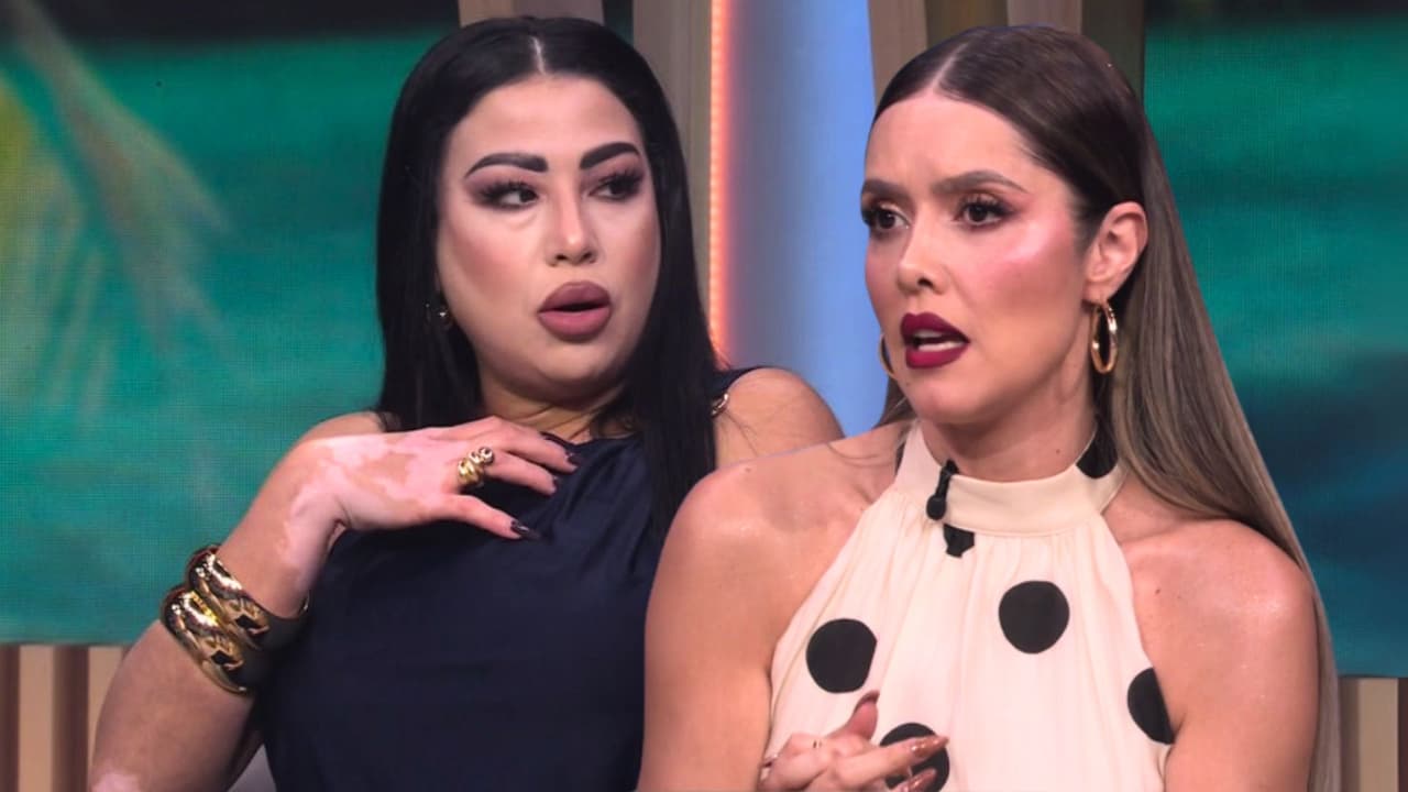 Luchar contra el vitiligo: modelo recuerda cómo lo enfrentó siendo una niña