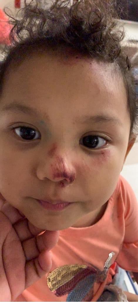 La niña cayó al piso cuando Carlos recibió el primer puñetazo