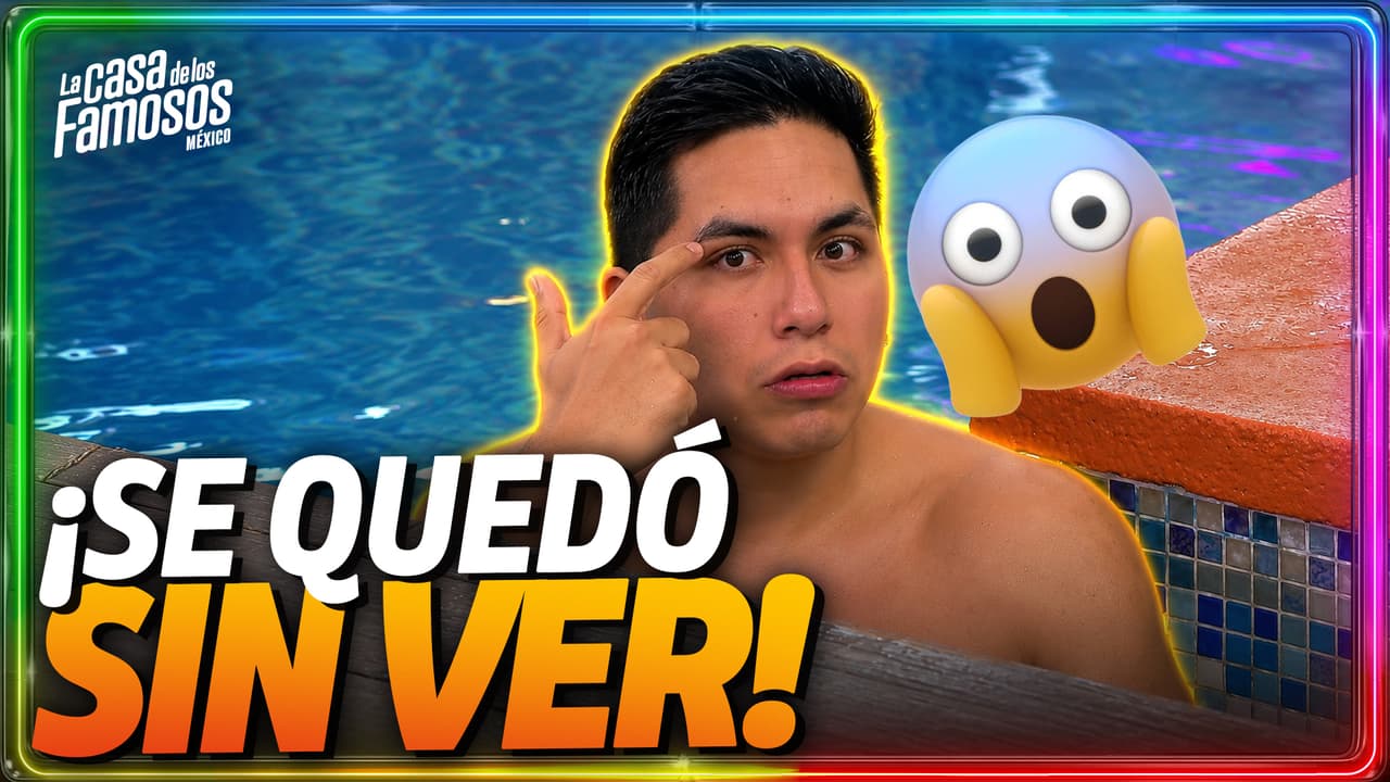 Le ROMPIERON el ojo a Ese Pérez en una pelea y le cambiaron la vida