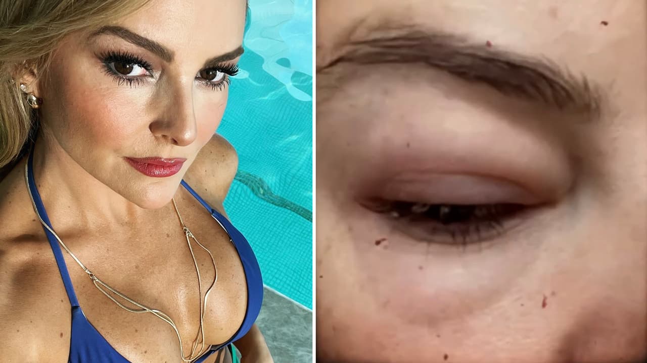 Marjorie de Sousa toma drástica decisión sobre su cuerpo tras extrañas inflamaciones: tenía “miedo”