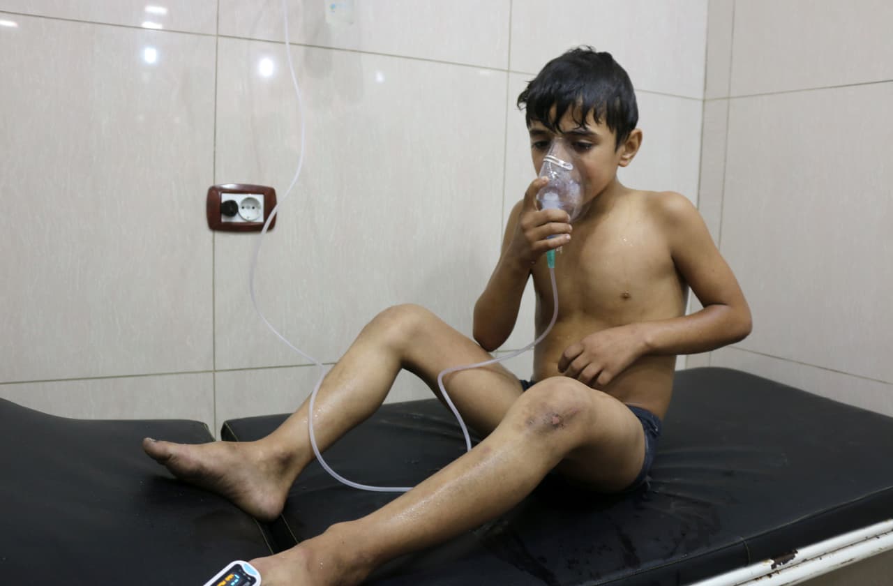 Un chico sirio es tratado en un hospital por dificultades respiratorias luego de que los helicópteros del gobierno lanzaran bombas en el vecindario de Sukkari, el 6 de septiembre de 2016.
