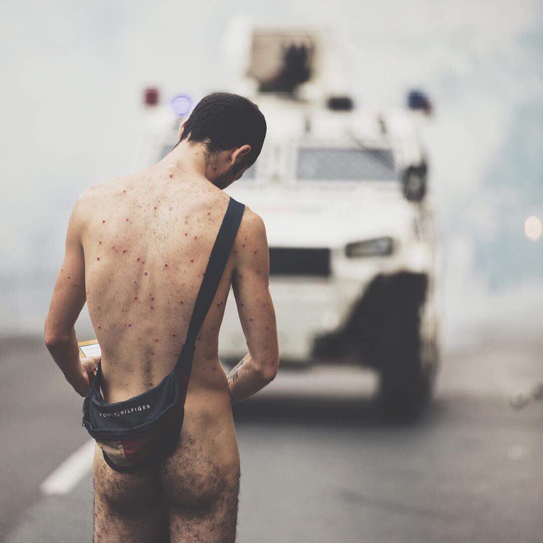 El joven marchó durante la protesta opositora de este jueves. (Twitter/Somos Venezuela)