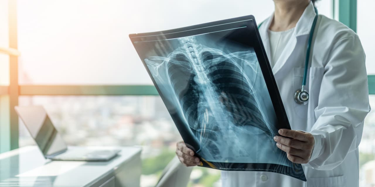<h3 class="cms-H3-H3">17. Cáncer respiratorio e intratorácico</h3>
<br>
<br>🏥 
<b>Crecimiento en costo por caso de acuerdo con el Índice de Gastos Médicos: </b>3.61
<br>
<br>🏥 
<b>Aumento del gasto en los últimos 10 años registrados:</b> 51.9%
<br>