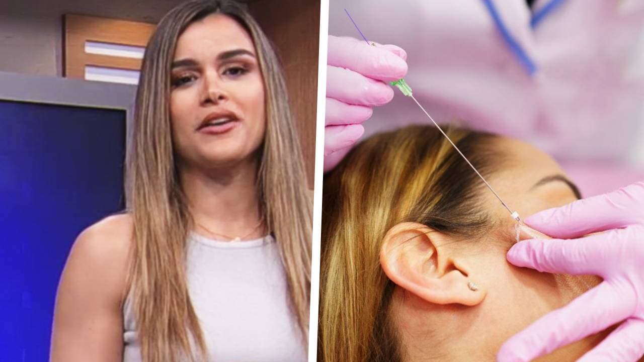 Clarissa Molina descubrió cómo eliminar la papada con la técnica de hilos tensores