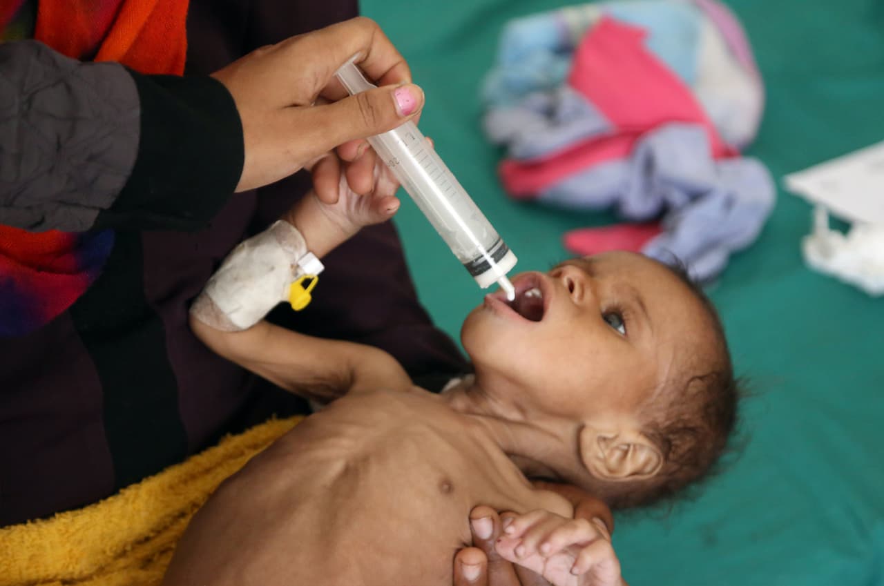 Yemen es uno de los países más pobres del Medio Oriente y desde marzo de 2015 se enfrentan las fuerzas su presidente Abd Rabbu Mansour Hadi, apoyado por Arabia Saudita, 
<a href="https://www.univision.com/noticias/ataques/decenas-de-ninos-muertos-y-heridos-las-dramaticas-imagenes-de-un-ataque-contra-un-autobus-escolar-en-yemen-fotos">contra los combatientes y aliados del movimiento rebelde de los hutíes, supuestamente apoyados por Irán.</a>