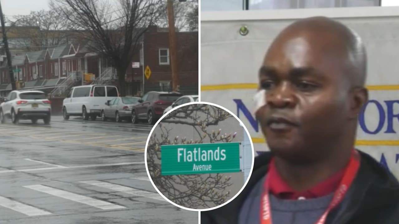 Taxista sobrevive a disparo en la cara tras ataque de pasajero: esto fue lo que dijo