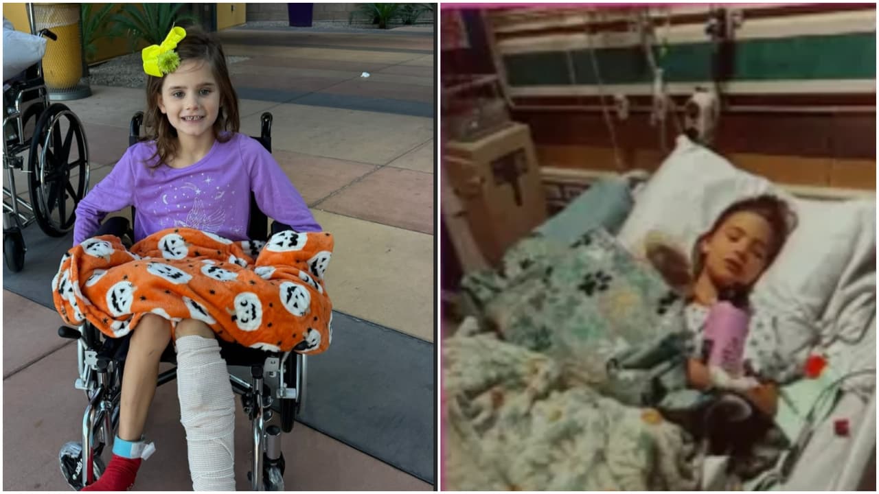 No se dio cuenta ni tenía marcas: Una niña es mordida por una víbora de cascabel y estuvo 30 horas sin atención médica