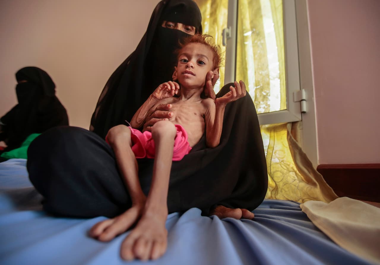 Desde el bloqueo “las importaciones comerciales de alimentos a través del puerto de Hodeidah se han reducido en más de 55,000 toneladas métricas por mes. Eso es suficiente para satisfacer las necesidades de 4.4 millones de personas, incluidos 2.2 millones de niños”, asegura la organización Save the Children.
