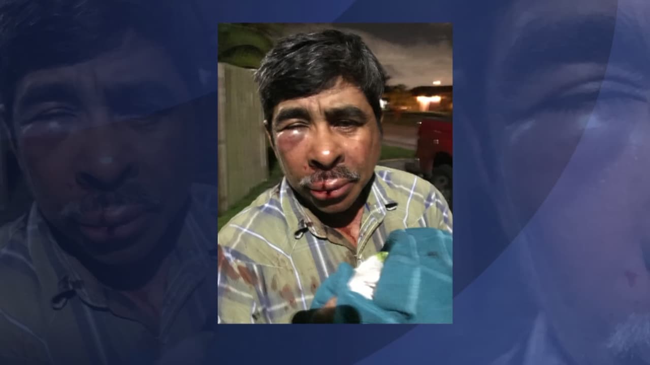 Marcelo dijo que los dos hombres eran un afroamericano y otro de raza blanca. La policía de Miami-Dade se encuentra investigando el caso, pero hasta ahora no han compartido ninguna información. 
<br>