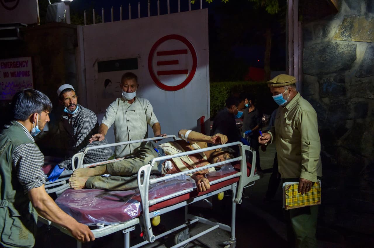 El aeropuerto Hamid Karzai se ha vuelto el epicentro de la emigración masiva de afganos luego de la toma del poder de los talibanes días atrás. En la fotografía uno de los heridos en las explosiones.