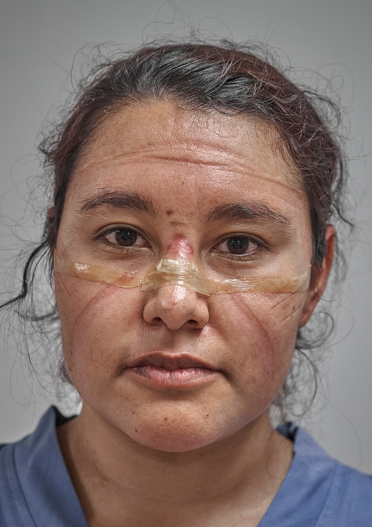 <b>Una trabajadora de la primera línea contra el covid-19</b>.
<br>
<br>Una médica al final de su turno en la Ciudad de México, México. En la imagen se aprecia las marcas que dejó la máscara protectora y los lentes en su rostro, 
<a href="https://www.univision.com/noticias/america-latina/en-fotos-la-pandemia-del-coronavirus-y-sus-estragos-en-mexico-donde-se-han-contagiado-mas-de-900-000-personas-fotos"><u>en uno de los países más afectados por la pandemia</u></a>. La fotografía ganó el segundo lugar en la categoría ‘retratos’.