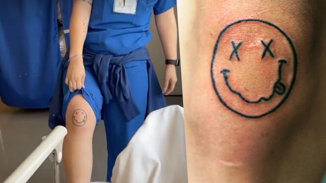 <h3 class="cms-H3-H3">J Balvin </h3>
<br>
<br>En plena endoscopia, 
<a href="https://www.univision.com/musica/los-10-artistas-mas-bellos-de-la-musica" target="_blank">J balvin</a> conoció una admiradora suya. La mujer, quien trabajaba en el lugar, estaba nerviosa al saber que su ídolo musical estaba en el hospital, lo particular es que ella tenía tatuada una “cara feliz”, la misma que 
<a href="https://www.univision.com/musica/los-aviones-privados-de-famosos-fotos" target="_blank">el cantante de ‘Rojo’ </a>tiene ubicada en la rodilla.