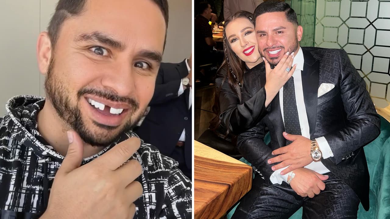 A Larry Hernández se le cayó un diente y Kenia dice que eso le pasa por "meterse con ella"