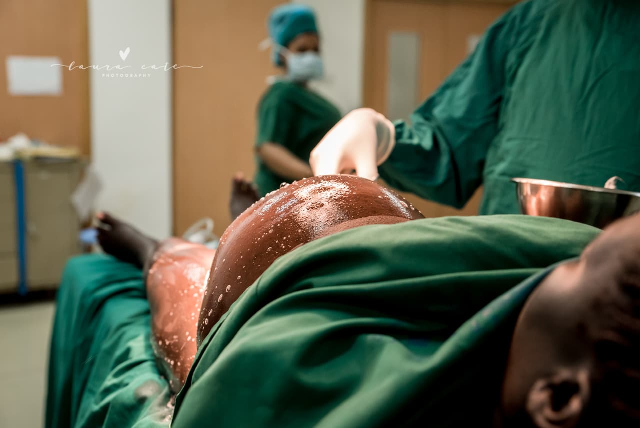 <b>"Antes del corte"</b>, por 
<a href="https://www.lauracatephotography.com/">Laura Cate</a> (Kampala, Uganda). Tercer lugar en la categoría 'Parto'.