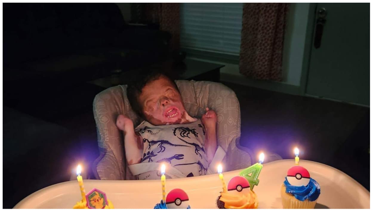 El niño Ja’Bari Grey que nació sin piel, festejó su cuarto cumpleaños