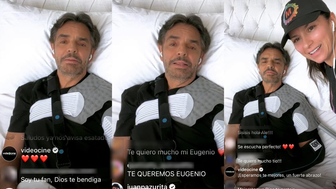 Explicó que 
<b><a href="https://www.univision.com/famosos/accidente-eugenio-derbez-polifracturado">terminó con 15 fracturas en el hombro</a></b> tras estar realizando un juego de realidad virtual. 
<br>