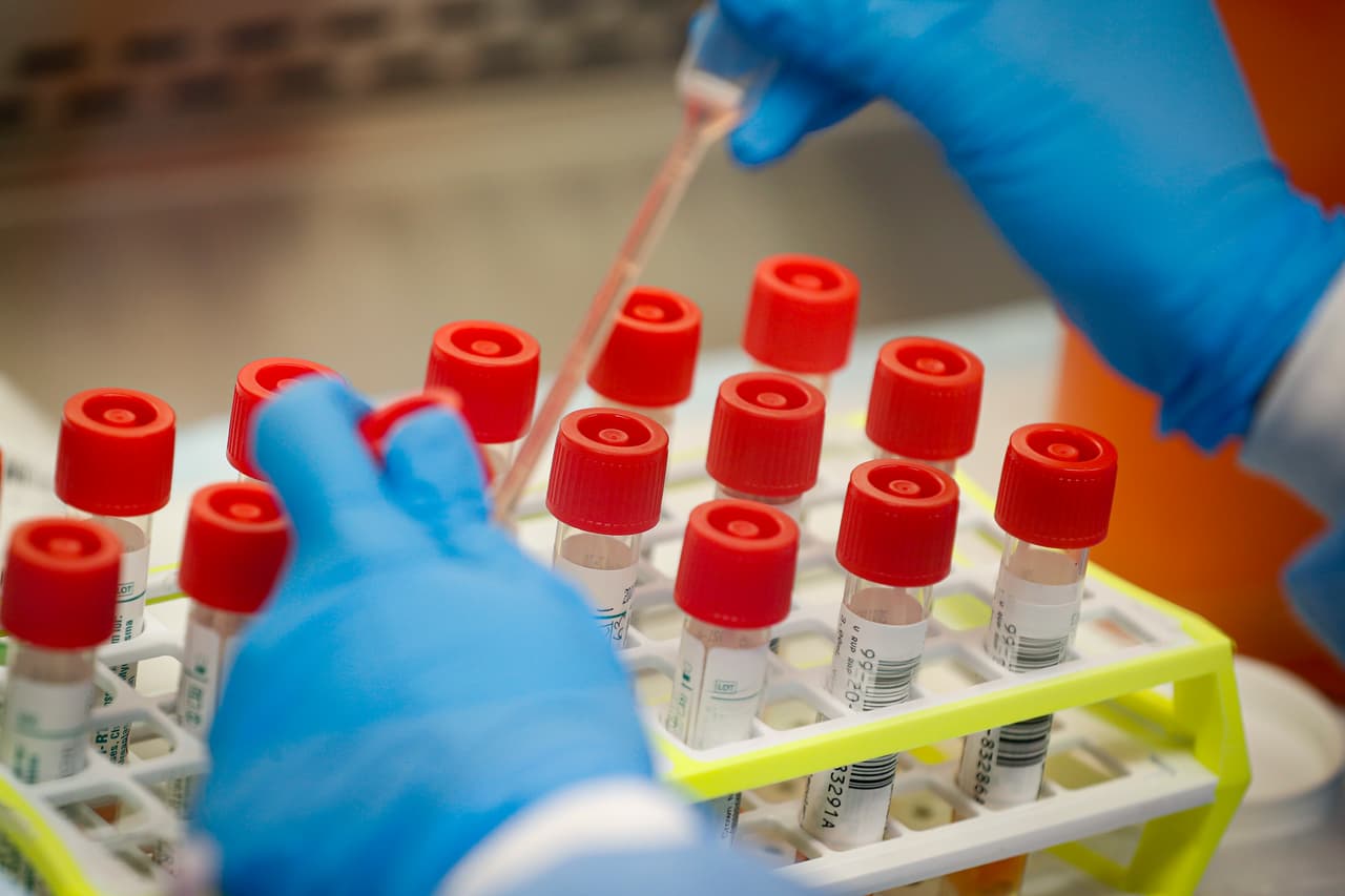 FDA autoriza el uso limitado y bajo control de dos medicamentos contra la malaria para tratar el covid-19