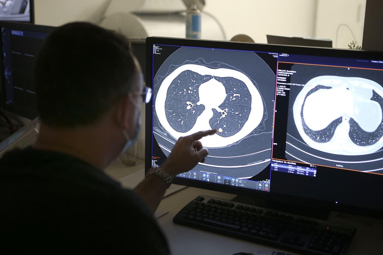 Casi la mitad de las muertes por cáncer se debe a factores de riesgo prevenibles, advierte nuevo estudio