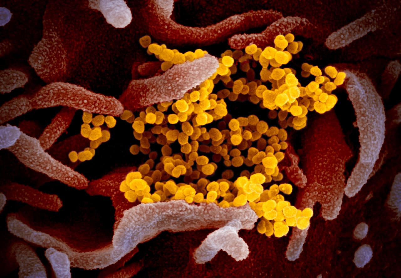 Las imágenes, publicadas por el 
<a href="https://www.niaid.nih.gov/news-events/novel-coronavirus-sarscov2-images" target="_blank">Instituto Nacional de Alergias y Enfermedades Infecciosas de EEUU</a> (NIAID, por sus siglas en inglés), se lograron con los microscopios electrónicos de barrido y transmisión que esta institución tiene en sus laboratorios de Hamilton, Montana.