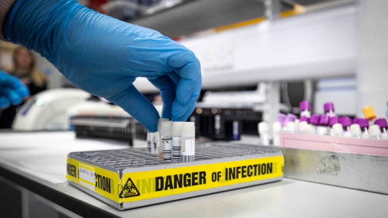 Confirman la primera muerte por coronavirus en el condado de Los Ángeles