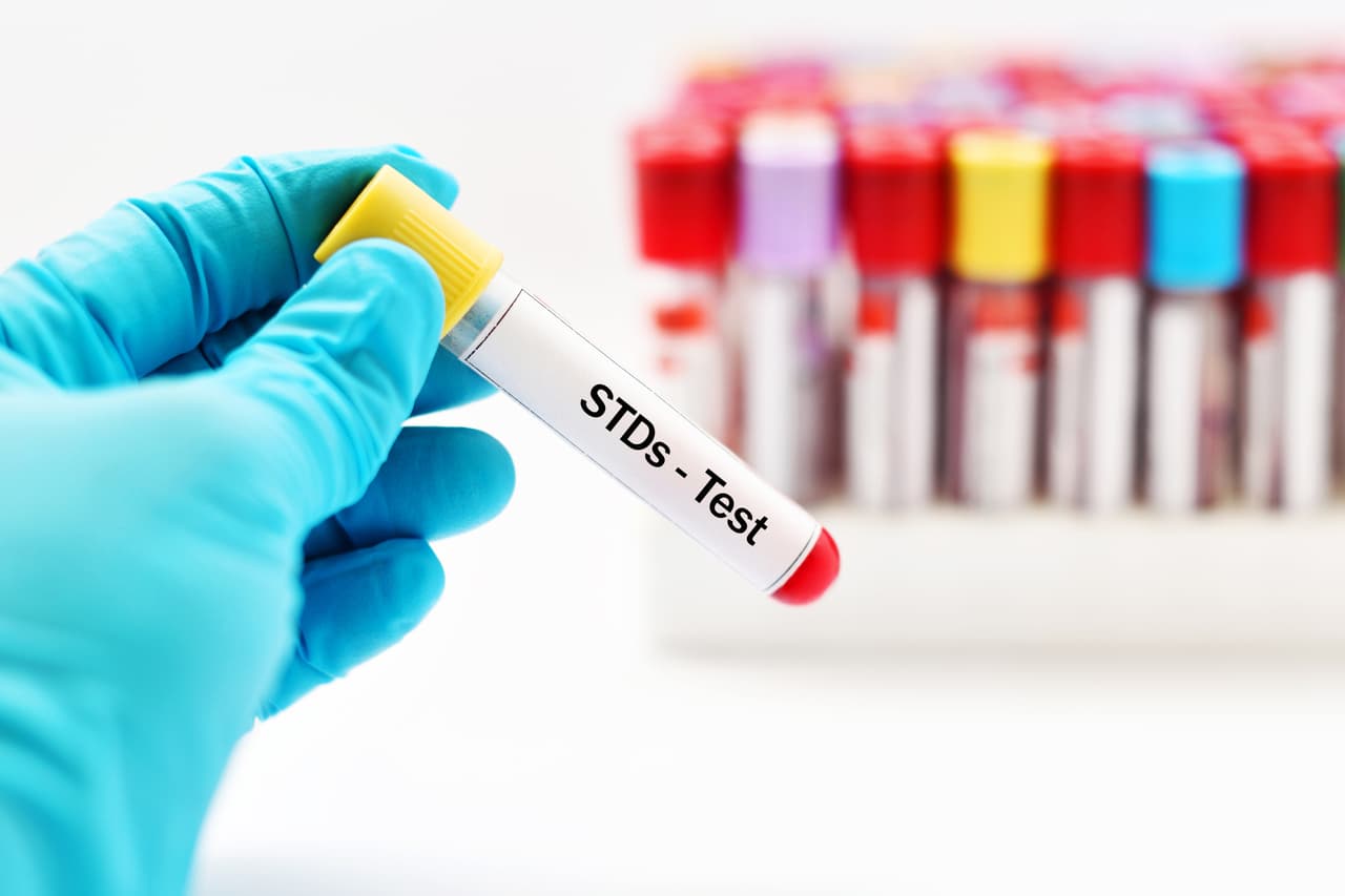 <b>Las ETS y el VIH. </b>Las personas que tienen enfermedad de transmisión sexual tienen 
<a href="https://www.cdc.gov/std/spanish/vih/stdfact-hiv-and-stds-s.htm">más probabilidades de contraer el VIH</a>, el virus que 
<a href="https://www.univision.com/noticias/vih-y-sida/lo-que-debes-saber-del-vih-el-virus-que-causa-el-sida-video">causa el sida</a>. Esto se debe a que las mismas conductas y circunstancias que te pueden poner en riesgo de contraer una ETS también te pueden poner en mayor riesgo de contraer el VIH. Además, si tienes una llaga o herida en la piel causada por una ETS, el VIH podría entrar con más facilidad al cuerpo.