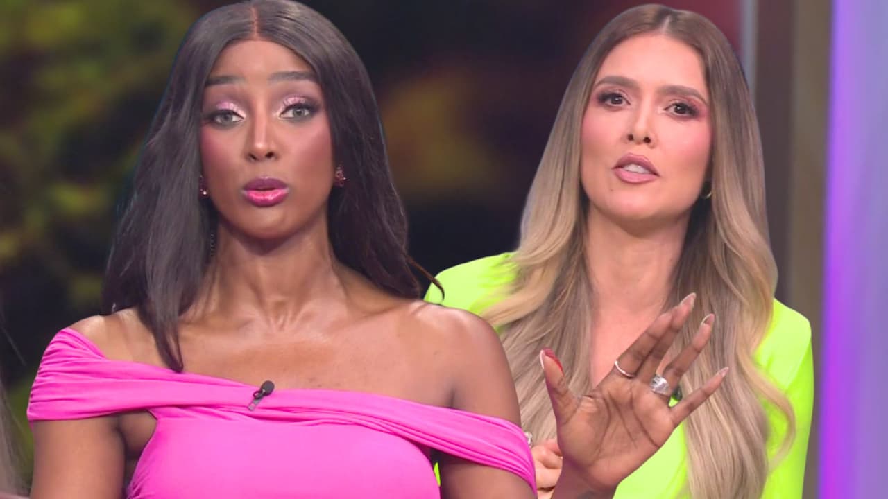 Amara responde si se inyectaría los labios tras ver el desastroso resultado de famosa influencer