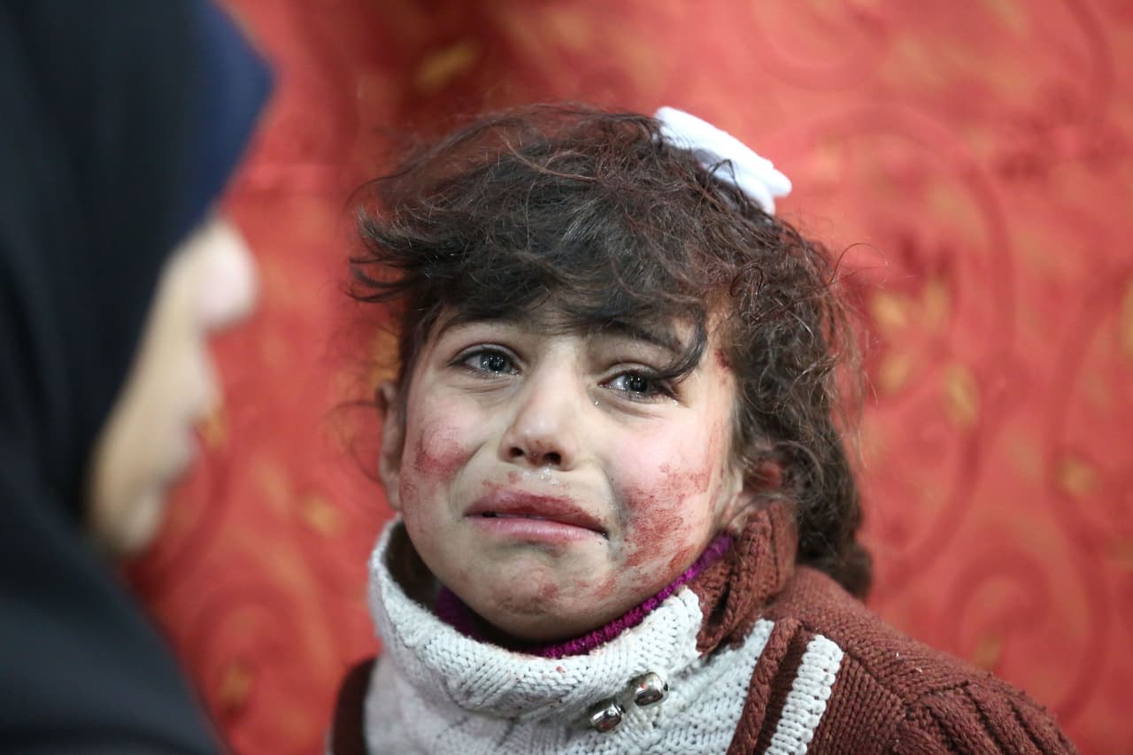 22 de febrero. Hala, de 9 años, recibe tratamiento en un hospital improvisado después de los bombardeos del gobierno sirio en la ciudad de Saqba.