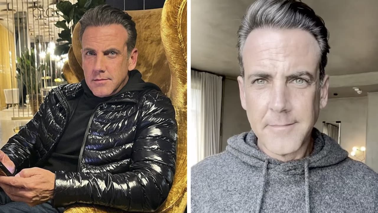 Le dicen a Carlos Ponce que "le pusieron mal el bótox" y él da una contundente explicación