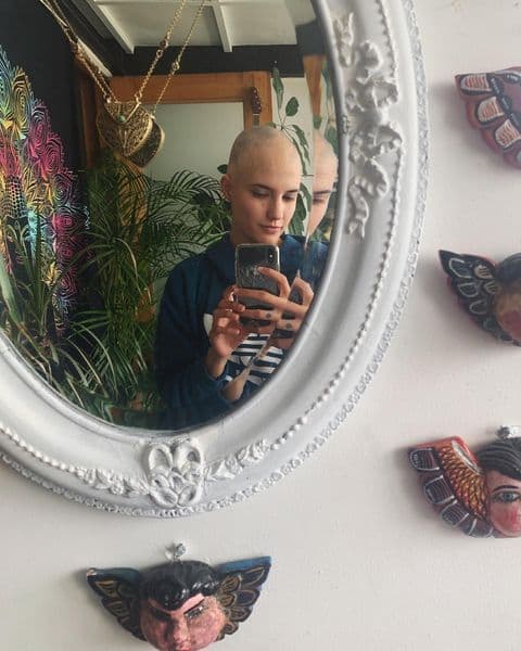 En su cuenta de Instagram, Camila contó cómo supo que viviría con esa enfermedad: "A los 3 años me dijeron que no me estresara, porque se me iba a caer el pelo. Vivía en pánico desde ese momento".