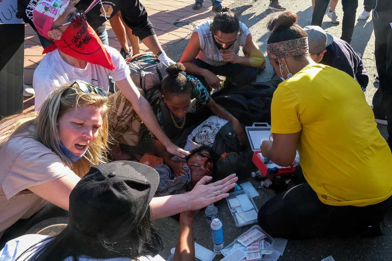 Las autoridades aseguraron que investigarían el incidente, sin embargo varios focos de protesta continuaron en Los Ángeles ese día, y también fueron reprimidos por la policía.
<br>